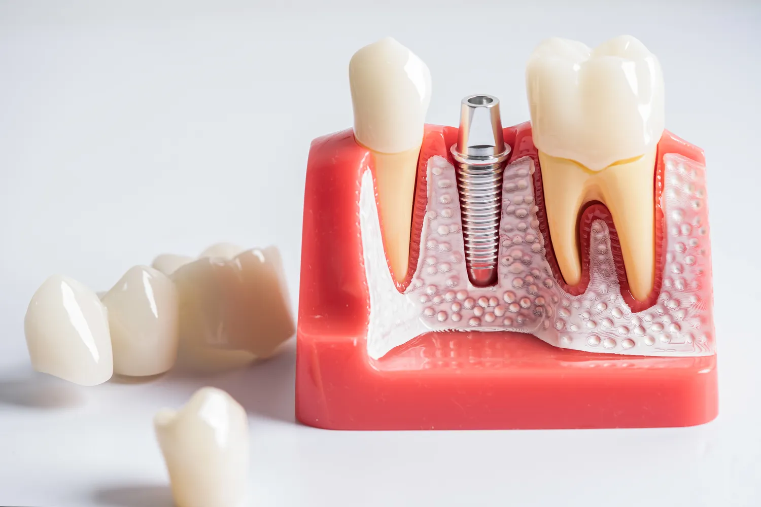 Wybór dobrego dentysty