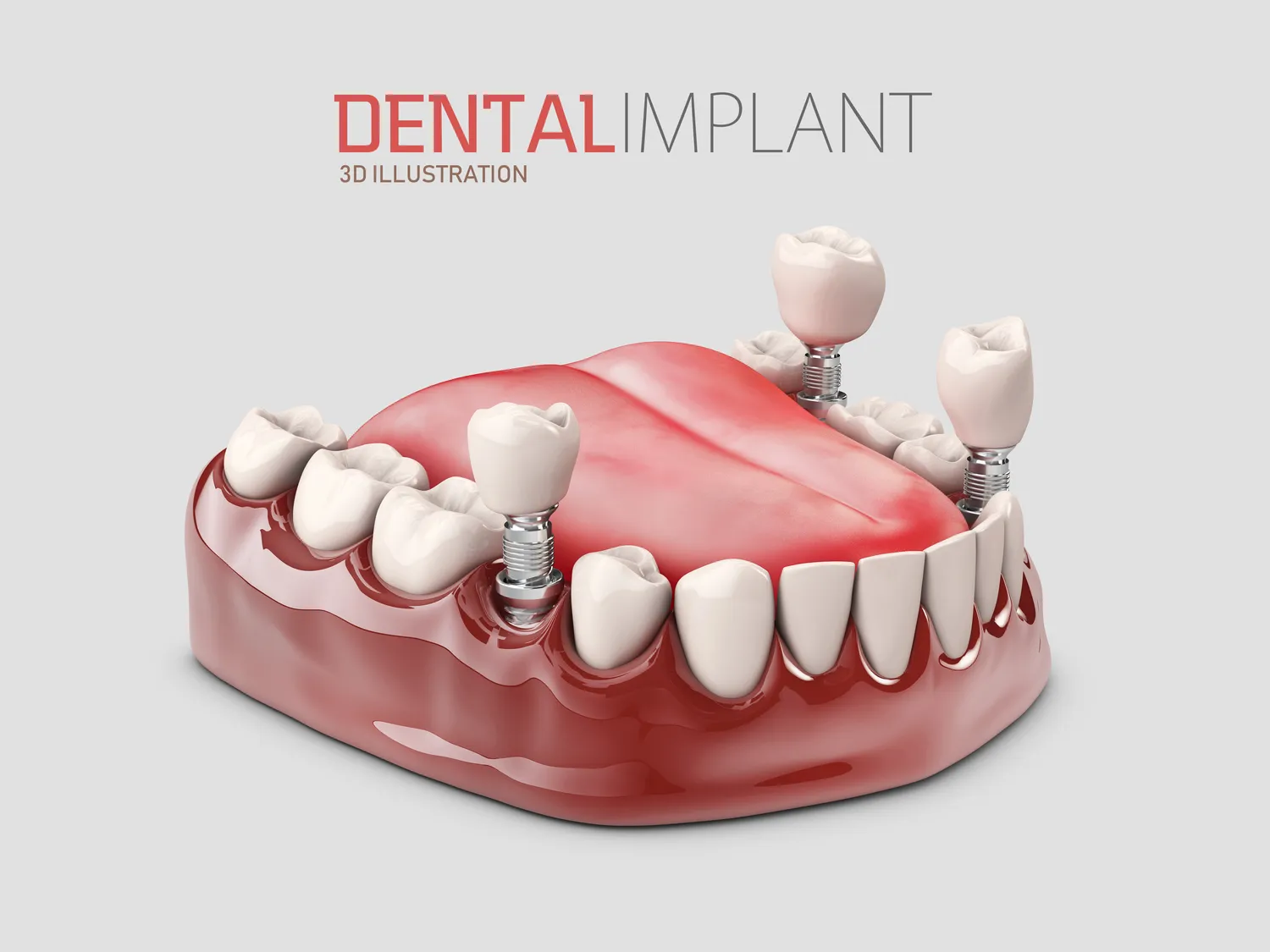 Endodoncja Szczecin