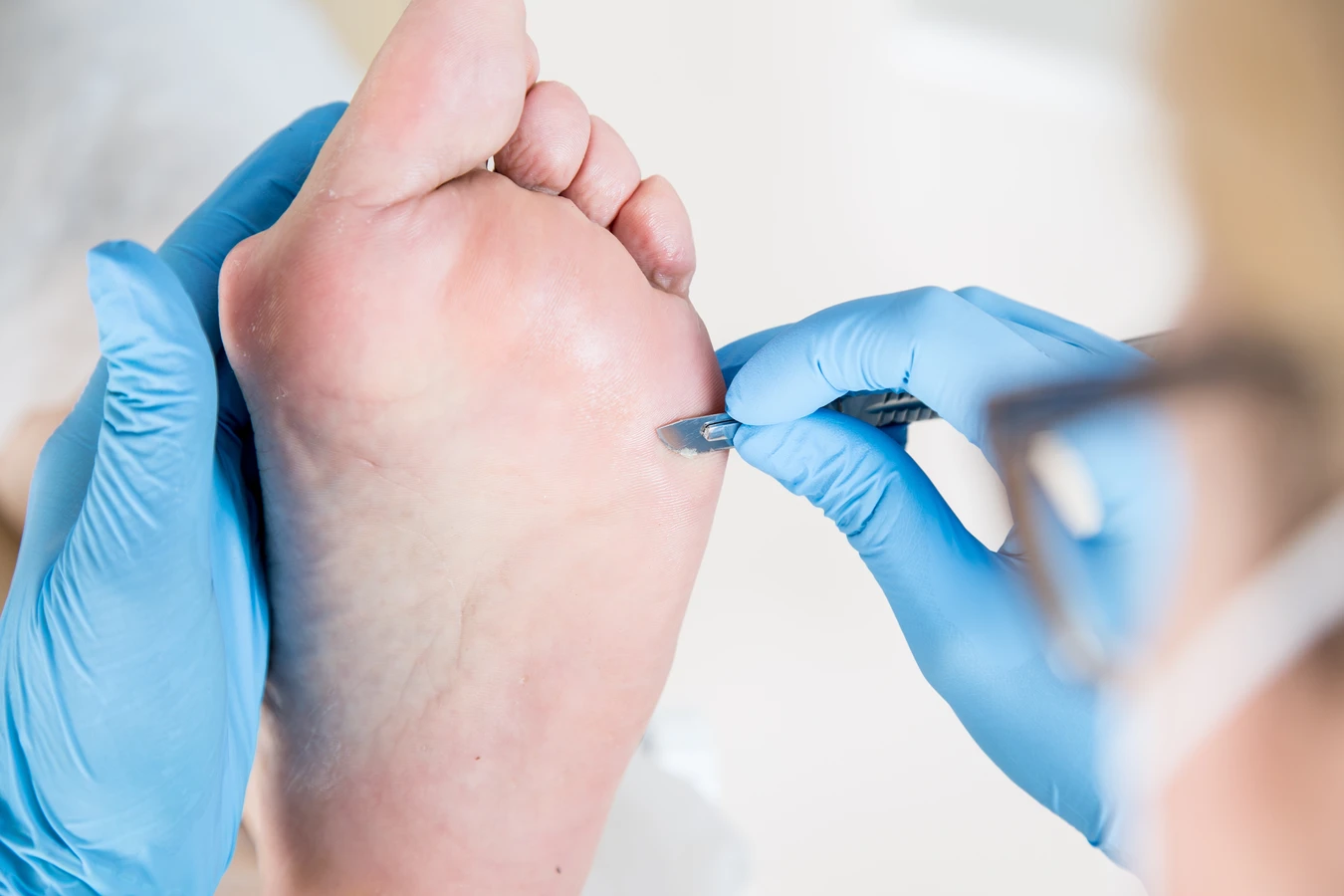 Co doradzają podolodzy, jeśli chodzi o pielęgnację stóp?