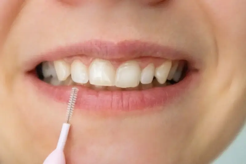 Na czym polega leczenie kanałowe?