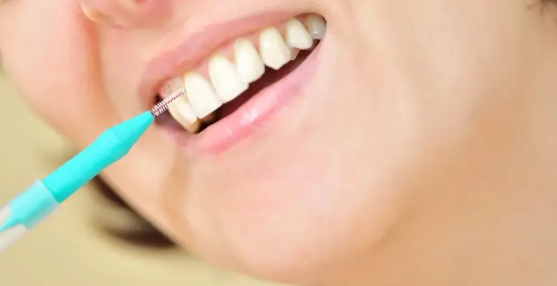 Najlepszy wybielanie zębów Szczecin