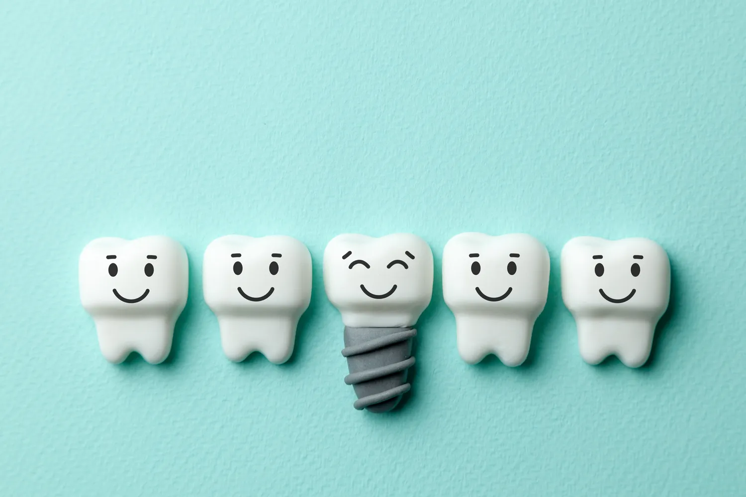 Ranking implantów zębowych – najważniejsze informacje